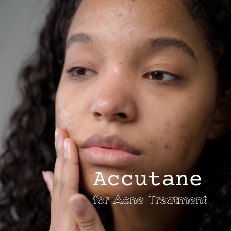accutane and acne treatment options