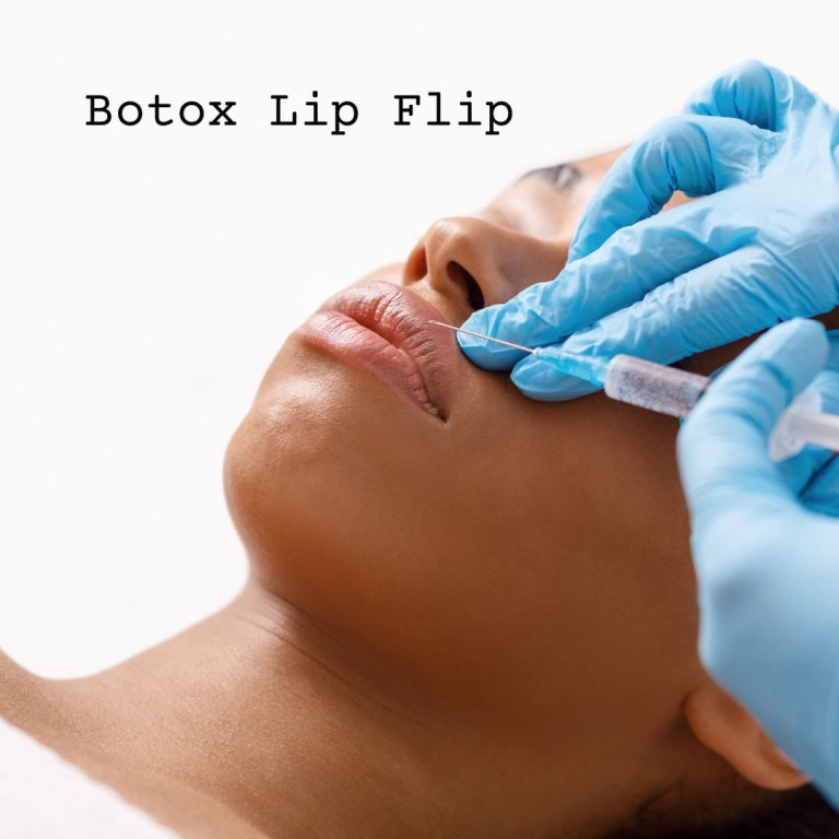 botox lip flip