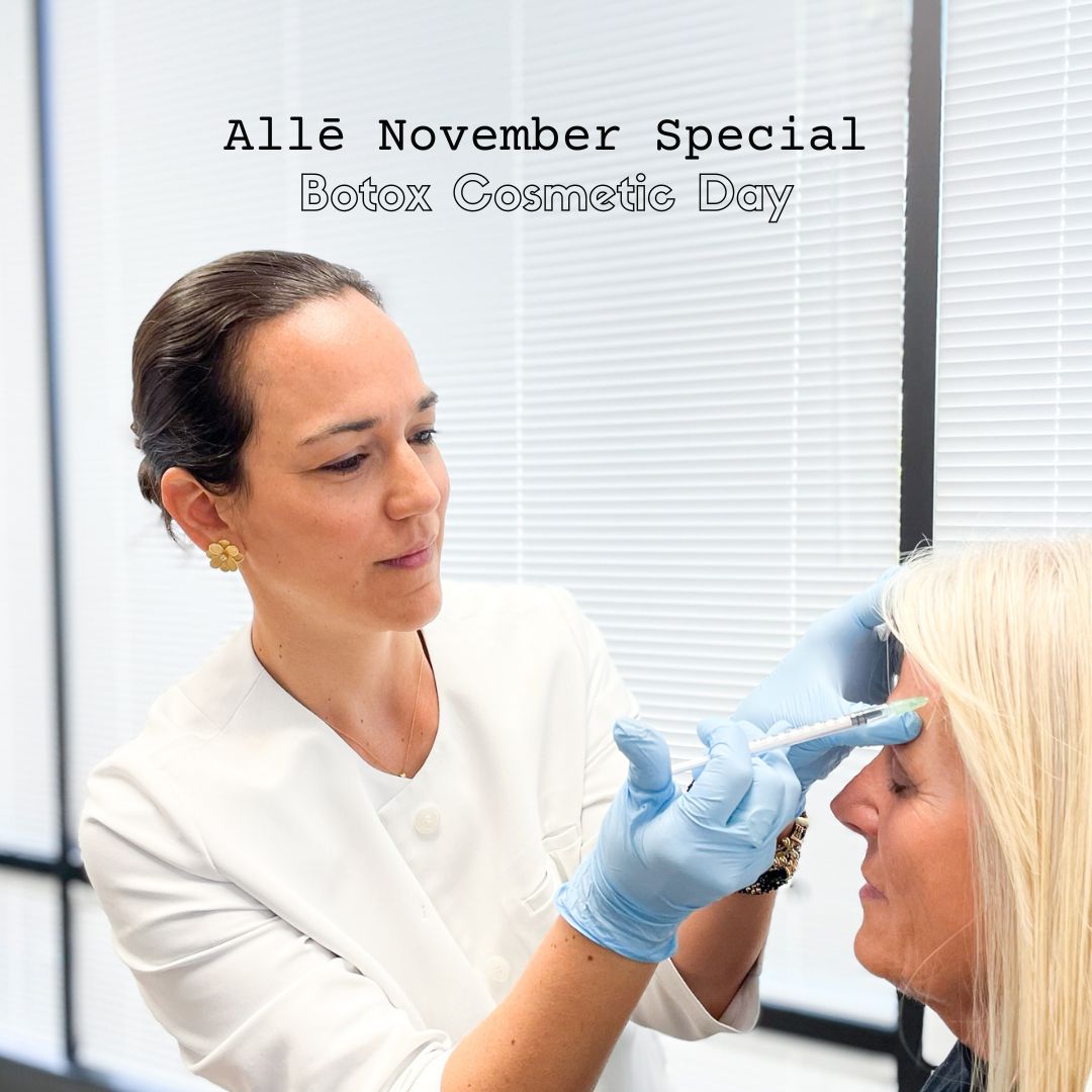 alle botox cosmetic day