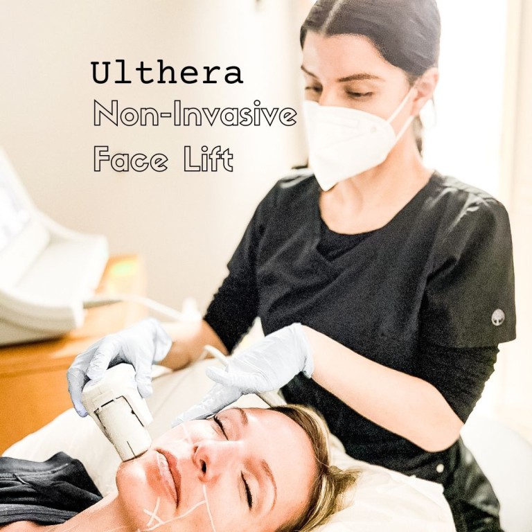ulthera non invasive face lift