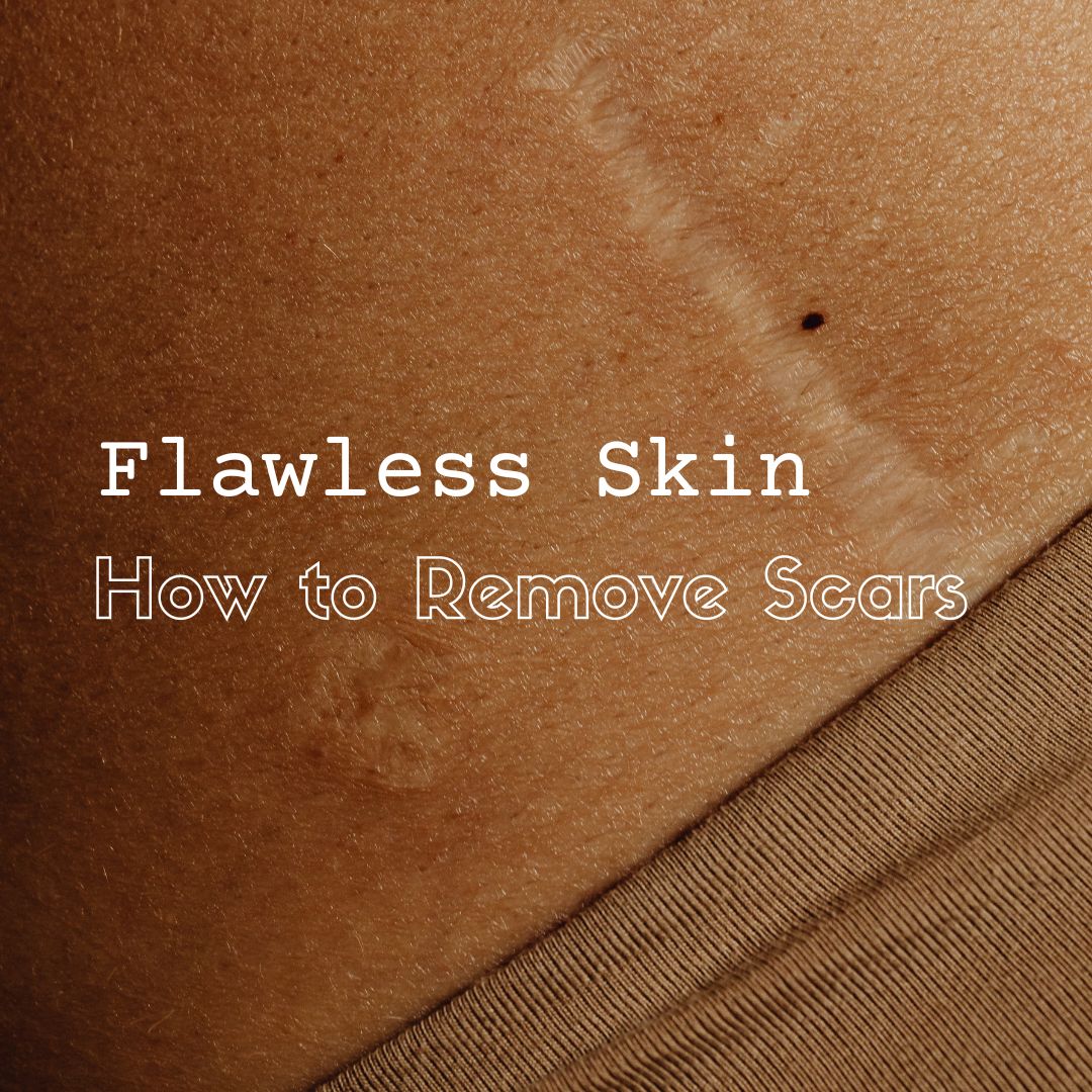 flawless skin how to remove scars
