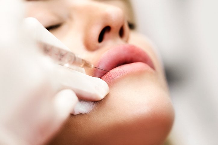 Picture showing dermal fillers being injected into lips