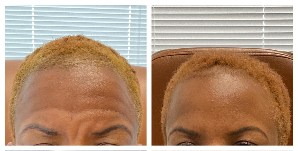 Before and After: Smooth