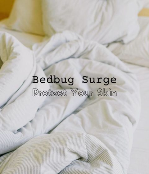 bedbug surge in NY how to treat skin