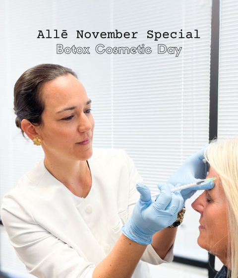 alle botox cosmetic day
