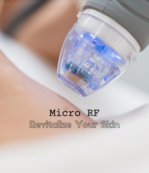 micro rf non invasive treatment at Simply Derm