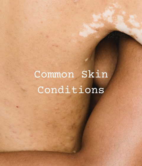 common skin conditions